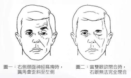 梅杰症最新治疗费用概述